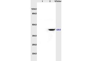 Lane 1: rat brain lysates Lane 2: rat heart lysates probed with Anti CD84/SLAMF5 Polyclonal Antibody, Unconjugated (ABIN741465) at 1:200 in 4 °C.