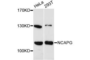 Western blot analysis of extracts of various cell lines, using NCAPG antibody (ABIN6291952) at 1:3000 dilution. (NCAPG Antikörper)
