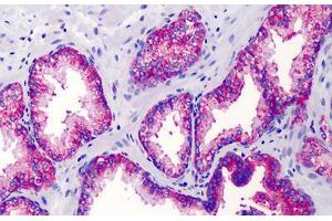 Human Prostate: Formalin-Fixed, Paraffin-Embedded (FFPE) (IKBKG Antikörper)