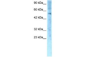 WB Suggested Anti-ZNF500 Antibody Titration: 0. (ZNF500 Antikörper  (Middle Region))