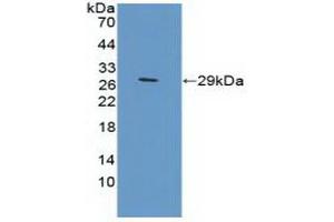 Detection of Recombinant TFR2, Mouse using Polyclonal Antibody to Transferrin Receptor 2 (TFR2) (Transferrin Receptor 2 Antikörper  (AA 86-259))