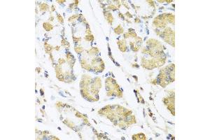 Immunohistochemistry of paraffin-embedded human stomach using MLN antibody (ABIN5973790) at dilution of 1/100 (40x lens). (Motilin Antikörper)