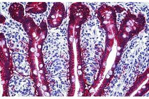 Human Intestine: Formalin-Fixed, Paraffin-Embedded (FFPE) (EpCAM Antikörper)