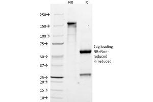 SDS-PAGE Analysis Purified MART-1 Monoclonal Antibody (M2-7C10). (MLANA Antikörper)