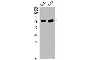 Western blot analysis of HELA A549 Cell Lysate, antibody was diluted at 1:1000. (DCT Antikörper  (AA 1268-1341))