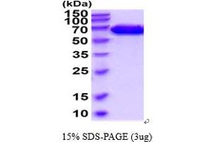 SDS-PAGE (SDS) image for EPH Receptor A4 (EPHA4) (AA 20-547) protein (His tag) (ABIN6387853)