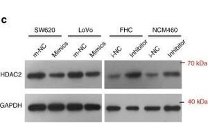 miR-500a-5p suppresses cell proliferation and invasion by targeting HDAC2 in vitro. (HDAC2 Antikörper  (C-Term))