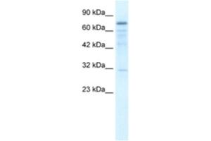Western Blotting (WB) image for anti-tRNA Methyltransferase 1 (TRMT1) antibody (ABIN2460992) (TRMT1 Antikörper)