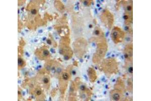 IHC-P analysis of Liver tissue, with DAB staining. (LRP1 Antikörper  (AA 692-962))