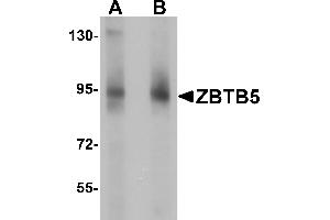 Western Blotting (WB) image for anti-Zinc Finger and BTB Domain Containing 5 (ZBTB5) (C-Term) antibody (ABIN1030813)