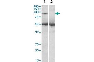 USP6 polyclonal antibody (2 ug/mL) staining of human placenta lysate (35 ug protein in RIPA buffer) with (lane 2) and without (lane 1) blocking with the immunizing peptide. (USP6 Antikörper  (C-Term))