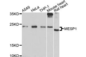 Western blot analysis of extracts of various cell lines, using MESP1 antibody (ABIN6003846) at 1/1000 dilution. (MESP1 Antikörper)