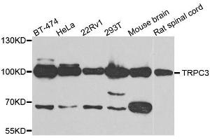 Western blot analysis of extracts of various cell lines, using TRPC3 antibody. (TRPC3 Antikörper)