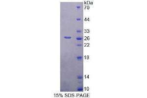 SDS-PAGE analysis of Rat BAG1 Protein. (BAG1 Protein)