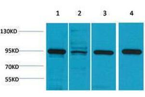 Western Blotting (WB) image for anti-Heat Shock Protein 90kDa alpha (Cytosolic), Class A Member 1 (HSP90AA1) antibody (ABIN3188034) (HSP90AA1 Antikörper)