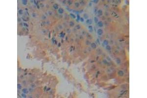 Figure. (Mucosae Associated Epithelia Chemokine (AA 17-130) Antikörper)
