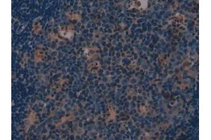 IHC-P analysis of Mouse Lymph node Tissue, with DAB staining. (Involucrin Antikörper  (AA 301-460))