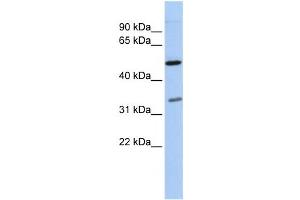 Western Blotting (WB) image for anti-Polyglutamine Binding Protein 1 (PQBP1) antibody (ABIN2457939) (PQBP1 Antikörper)