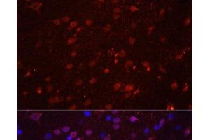 Immunofluorescence analysis of Rat brain using GRIN2B Polyclonal Antibody at dilution of 1:100. (GRIN2B Antikörper)