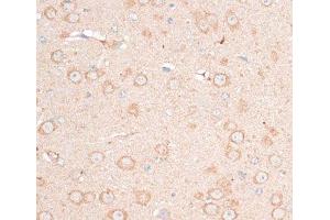 Immunohistochemistry (Paraffin-embedded Sections) (IHC (p)) image for anti-Cadherin 18, Type 2 (CDH18) antibody (ABIN7258012)