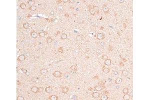 Immunohistochemistry of paraffin-embedded Mouse brain using CDH18 Polyclonal Antibody at dilution of 1:100 (40x lens). (CDH18 Antikörper)