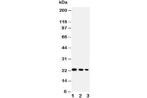 Western blot testing of BAFF antibody and Lane 1:  recombinant human protein 10ng;  2: 5ng;  3: 2.
