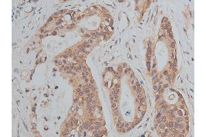 Immunohistochemistry (IHC) image for anti-Cadherin 1, Type 1, E-Cadherin (Epithelial) (CDH1) (C-Term) antibody (ABIN6261408)