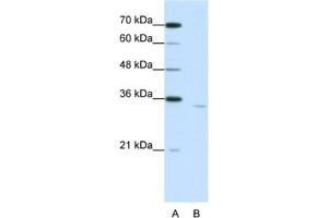 Western Blotting (WB) image for anti-Cytoplasmic Polyadenylation Element Binding Protein 2 (CPEB2) antibody (ABIN2462356)