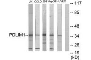 Western blot analysis of extracts from Jurkat/COLO205/293/HepG2/HuvEc cells, using PDLIM1 Antibody. (PDLIM1 Antikörper  (AA 61-110))