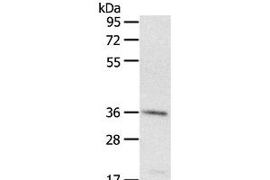 Western Blot analysis of A431 cell using PDLIM4 Polyclonal Antibody at dilution of 1:400 (PDLIM4 Antikörper)
