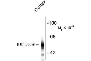 Western blots of rat cortex lysate showing specific immunolabeling of the ~55k beta III tubulin protein. (TUBB3 Antikörper)