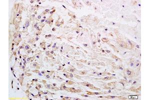Immunohistochemistry (IHC) image for anti-Wingless-Type MMTV Integration Site Family, Member 1 (WNT1) (AA 251-350) antibody (ABIN733748)