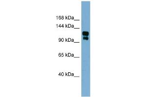 WB Suggested Anti-TRPA1 Antibody Titration:  0. (TRPA1 Antikörper  (Middle Region))