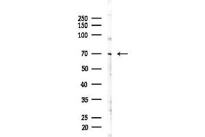 Western blot analysis of lysates from PC12 cells(starvation 24h treatment), using KIFC1 Antibody at 1/1000 dilution.