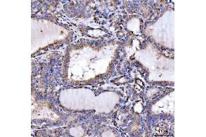 IHC analysis of SLU7 using anti-SLU7 antibody (ABIN7601697). (SLU7 Antikörper  (AA 42-474))