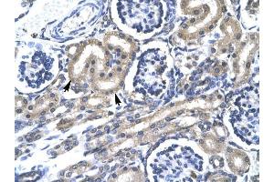 TRAFD1 antibody was used for immunohistochemistry at a concentration of 4-8 ug/ml to stain Epithelial cells of renal tubule (lndicated with Arrows] in Human Kidney. (TRAFD1 Antikörper  (C-Term))