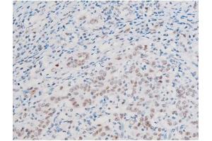 Immunohistochemistry (IHC) image for anti-LIM Domain Kinase 2 (LIMK2) (pSer283) antibody (ABIN6256239)