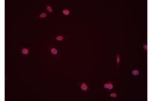 ABIN6274008 staining Hela cells by IF/ICC. (DUSP6 Antikörper  (Internal Region))