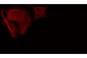 ABIN6274835 staining HeLa cells by IF/ICC. (SGCA Antikörper  (Internal Region))