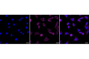 Immunocytochemical staining of C2C12 cells with NDUFS2 antibody (ABIN7799556), 1:1,000).