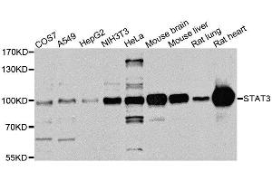 Western blot analysis of extracts of various cell lines, using STAT3 antibody. (STAT3 Antikörper  (AA 640-770))