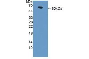 Detection of Recombinant LRP4, Human using Polyclonal Antibody to Low Density Lipoprotein Receptor Related Protein 4 (LRP4) (LRP4 Antikörper  (AA 1610-1885))