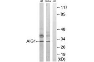 Western Blotting (WB) image for anti-Androgen-Induced 1 (AIG1) (AA 196-245) antibody (ABIN2890118) (AIG1 Antikörper  (AA 196-245))