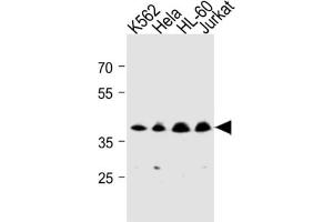 Western Blotting (WB) image for anti-Mitochondrial Trans-2-Enoyl-CoA Reductase (MECR) antibody (ABIN3004507) (MECR Antikörper)