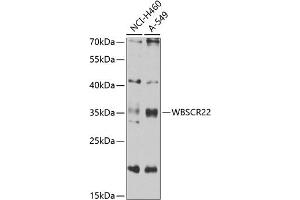 Western blot analysis of extracts of various cell lines, using WBSCR22 antibody (ABIN6132946, ABIN6150175, ABIN6150176 and ABIN6223157) at 1:1000 dilution. (WBSCR22 Antikörper  (AA 1-281))
