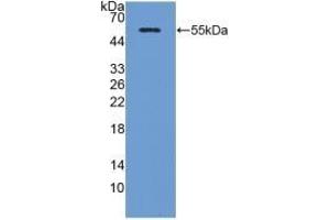 Detection of Recombinant ADP, Porcine using Polyclonal Antibody to Adiponectin (ADPN) (ADIPOQ Antikörper  (AA 17-243))