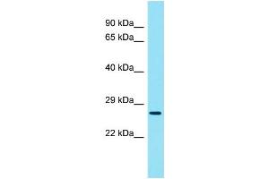 Western Blotting (WB) image for anti-Coiled-Coil Domain Containing 59 (CCDC59) (C-Term) antibody (ABIN2790739) (CCDC59 Antikörper  (C-Term))