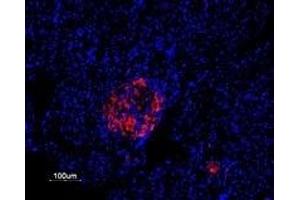 Immunohistochemistry (IHC) image for anti-Potassium Voltage-Gated Channel, Shab-Related Subfamily, Member 1 (KCNB1) (AA 841-857), (Intracellular) antibody (ABIN7043509)