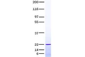 Validation with Western Blot (IL-6 Protein)