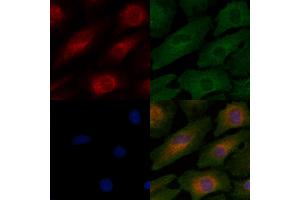 ABIN6259928 and ABIN6276407 staining  cells by IF/ICC. (Angiopoietin 2 Antikörper  (N-Term))